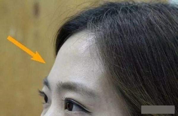 Cô ấy nên để tóc gì trên vầng trán hẹp?
